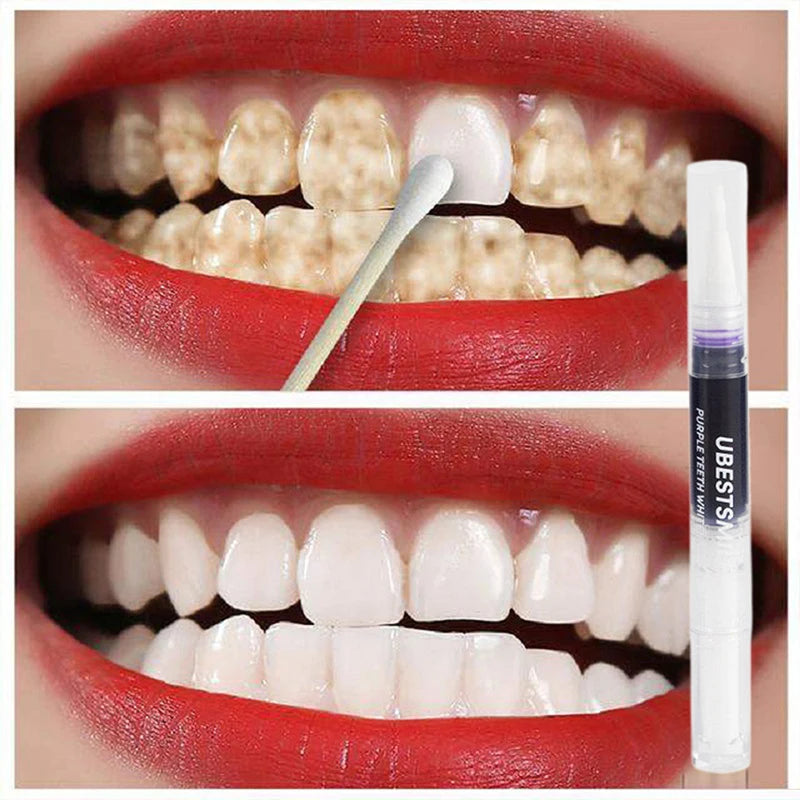 Instant Teeth Whitening Pen 3Pcs