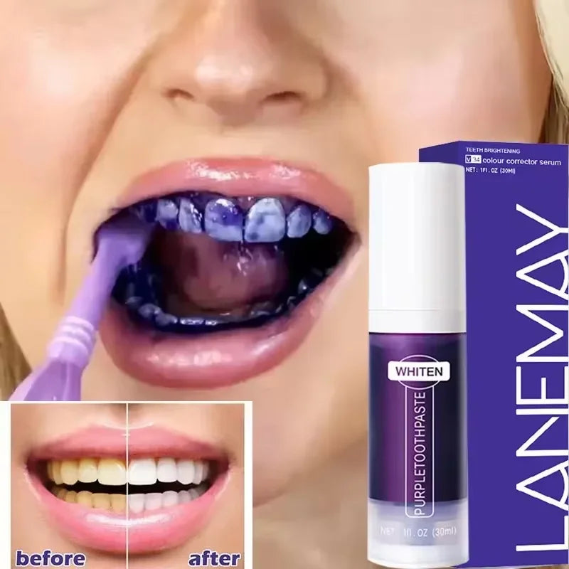 V34 Purple Teeth Whitening Toothpaste